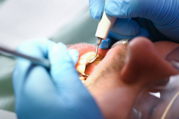 Best Same-Day Emergency Dentist in New Paris, OH